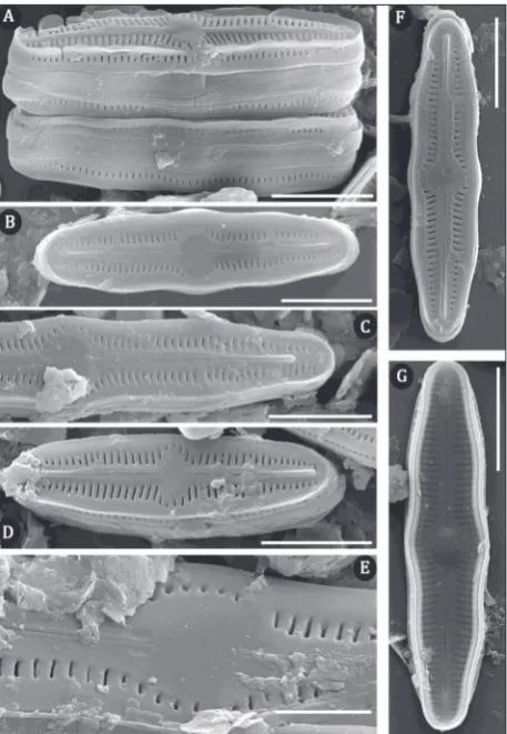 Fig. 2. SEM micrographs of H. brekkaensoides. Scale bar is 5 µm in A-D, F, G, and 2 µm in E.
