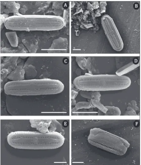Fig. 3. SEM micrographs of H. comperei. Scale bar is 5 µm in A, C, D, and 2 µm in B, E, F.