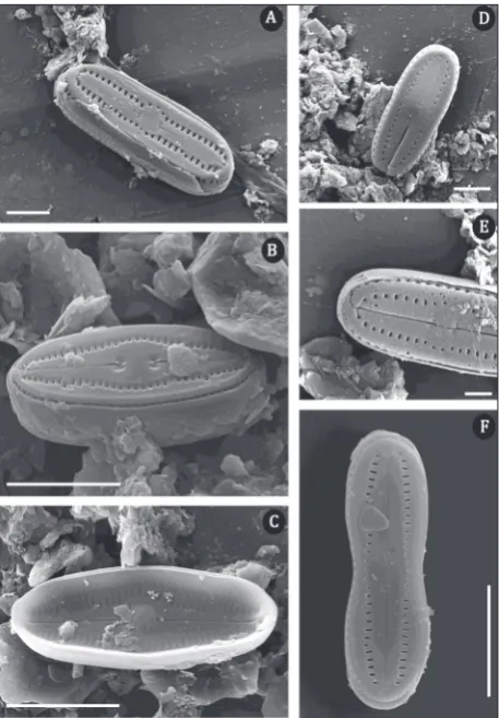 Fig. 6. SEM micrographs of DFA– H. pyrenaica; B, C– H. perpusilla; , E– H. contemnata; F–H
