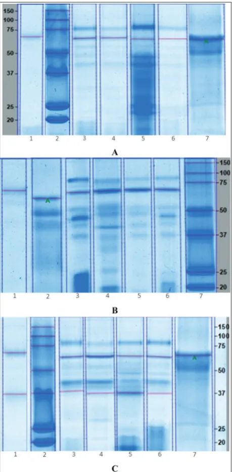 Table 2. For trypsin, the concentration ranged from 6.0-12.8 mg g-1 of tissue, and in C