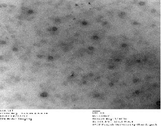 Fig 2:   Gamma scintigraphs of99mTc labeled  A) F-S B) S-SLNs 1 h Post IN administration 