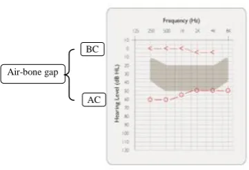 TABLE 1 INDICATION FOR BC HEARING AIDS  