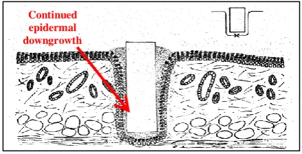 Fig. 4 Audiological indications for Baha system ® - 