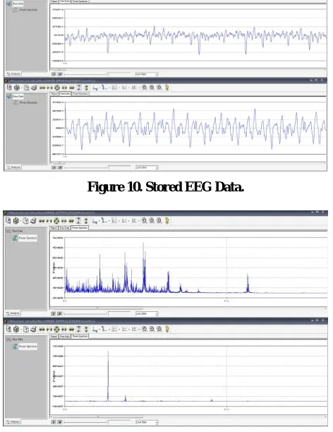 Figure 10. Stored EEG Data. 