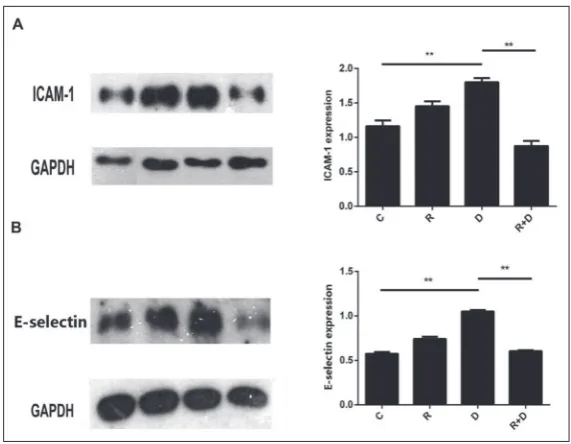 Fig. 3. Effects of the neutralizing antibodies against IL-1β on the expression of adhesion molecule (ICAM-1 and E-selectin) in HUVECs