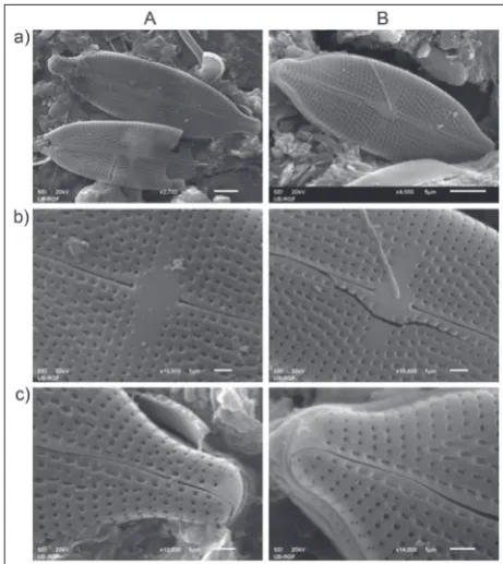 Fig. 2. SEM micrographs of two individuals (columns A and B) of A. stroesei from the Vrutci Reservoir – comparative overview; a – valves, b – central area; c – valve ends.