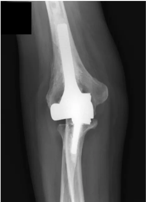 Figure 1 – Radiographic follow-up