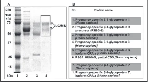 Fig. 1. A – SDS-PAGE of the PSG preparation; 1 – molecular weight markers (Bio-Rad, USA), 2 – pooled pregnant women serum, 3 – the sample after am-monium sulfate precipitation and ultrafiltration, 4 – the sample after affinity chromatography