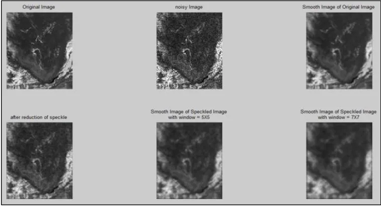 Fig. 4: Speckle Reduction Using DSF Filter and Obtained PSNR=18.99 