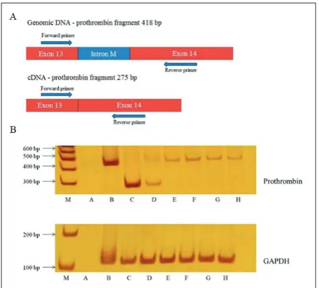 Fig. 1. Analysis of prothrombin gene expression. Schematic pre-sentation of primers used in PCR analysis of prothrombin gene expression (A), and PCR analysis of prothrombin gene expression (B)