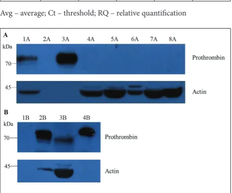 Table 1. Relative quantification of prothrombin gene expression achieved by qPCR.
