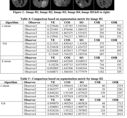 Figure 2 : Image H1, Image H2, Image H3, Image H4, Image H5(left to right) 