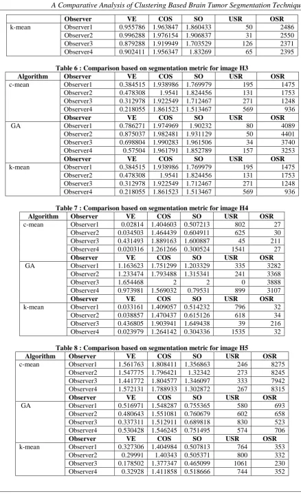 Table 6 : Comparison based on segmentation metric for image H3 Observer VE COS SO USR 