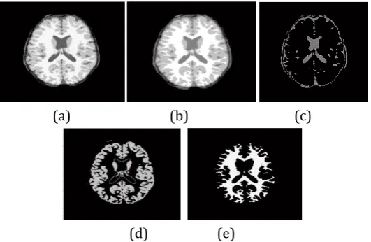 Fig. 5. Output images of algorithm (a) input image (b) Output of multistable CNN (c) pixels labeled as CSF 