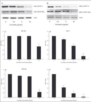 Fig. 6. qRT-PCR analysis of ODC1 mRNA expression in MCF-10A normal breast cells (A) and MCF-7 cancerous breast cells (B)