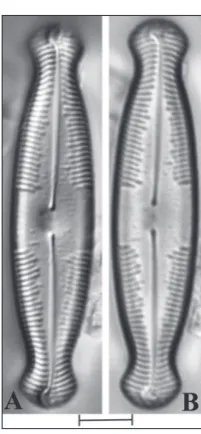 Fig. 3. LM micrograph of Image taken with Differential Interference Contrast (DIC) Caloneis budensis (x1600)