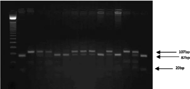 Figure 2: photograph of 3.5% agarose gel showing the digested PCR products for 308G/A polymorphism lanes 2 and 13
