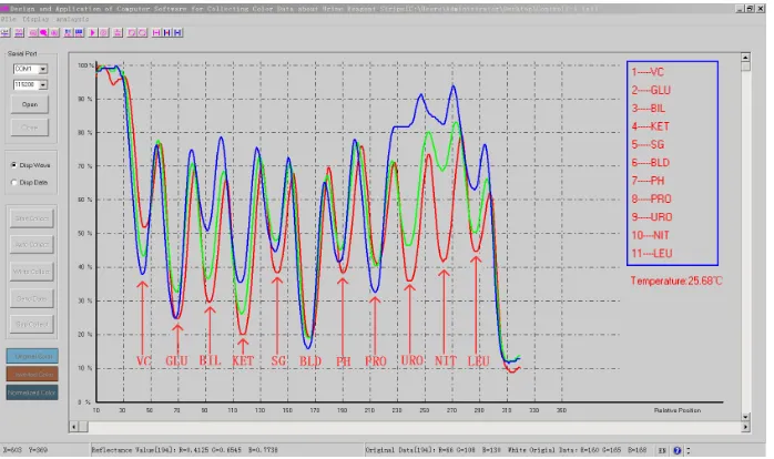 Figure 3. Data waveform of control I (strongly positive). 