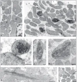 Table 2. The effect of environmental temperature on the morphological parameters (±SD) in brown adipocytes of rats delivered and raised at 33°C, as compared to animals delivered and raised at 20°C (control).