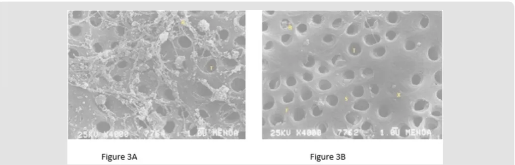 Figure 1: Figure 1A: Scanning electron micrography of root dentin Control (4000X); bar = 1.0 μm