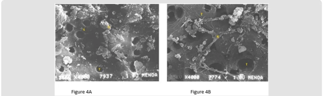 Figure 4: Figure 4A: Scanning electron micrograph of root dentin Control (4000X); bar = 1.0 μm