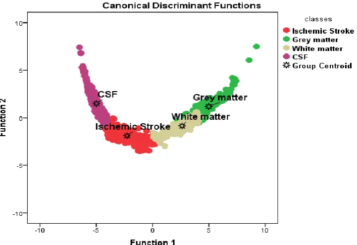 Fig .1 Scatter plot generated using discriminate analysis function for four classes represents: Ischemic stroke, gray  matter, white matter and CSF 