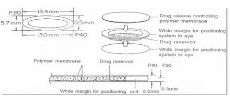 Fig 5: Schematic diagram of an ocusert controlled release drug delivery