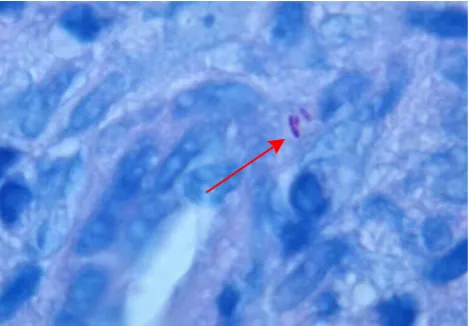 Figure 3 - Fite Faraco staining. Identification of Mycobacterium leprae bacilli.