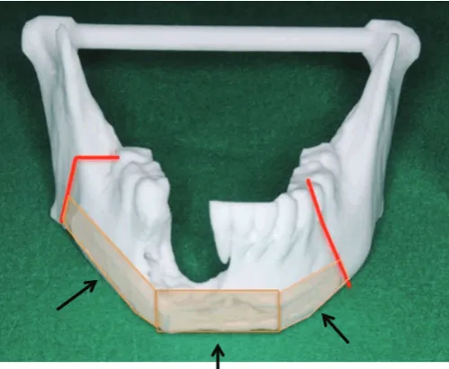 Figure 5(A and B). Because the remaining pieces from the 