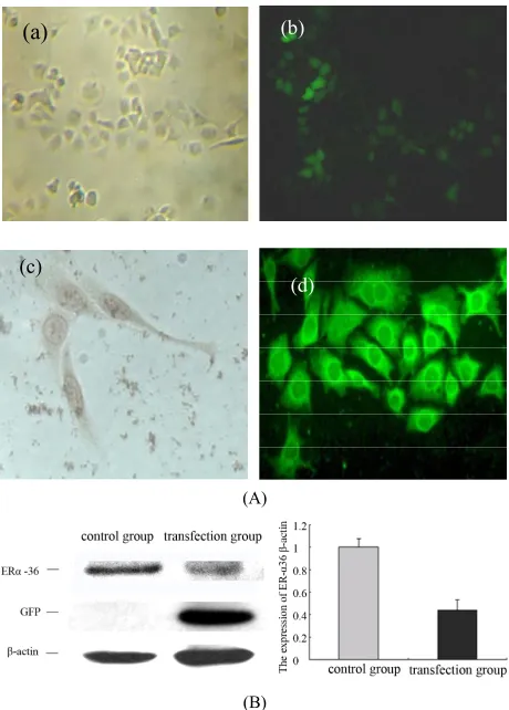 Figure 1. The transfection of ER-α36 shRNA down regulate the expression of ER-α36 in PC12 cells