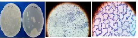 Fig. 1a and 1b: Media plates and microscopic image are showingAspergillus colonies isolated from worker’s clothes (chopping area).