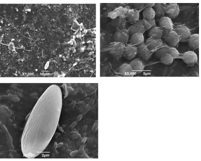 Fig. 3 Microphotographs of biofilm on the outer surface of the tube (x1000-8500) 