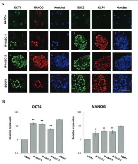 Fig. 3. Expression of pluripotent state-specific markers. A – im-munofluorescent staining shows expression of pluripotent mark-ers, OCT4, SOX2, KLF4 and NANOG in clones of reprogrammed hASC and parental cells