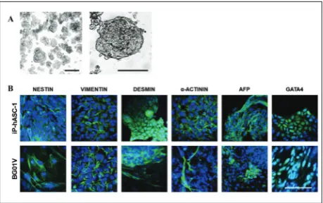 Fig. 4. In vitro differentiation of iP-hASC-1. A – Image of EBs generated in suspension in culture 20 days after formation