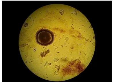 Fig. 1. Egg of nematode  Capillaria falconis (original, objective lens 8, eyepiece 10)  