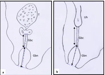 Fig. 1. Diagram showing Gbn and Gbc at E18. (a) Male (b) Female 
