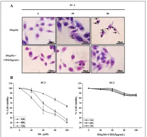 Fig. 3. DS induced S phase retardation but no sub-G1 peak as determined by flow cytometry