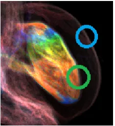 Figure 3: Electrophysiological simulation set sequence visualization results via ray-casting method.