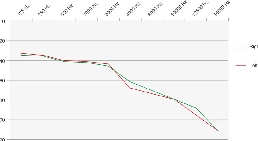 Figure 1 - Patient hearing-loss average thresholds (measured on a dB HL [hearing loss] scale) across several frequencies