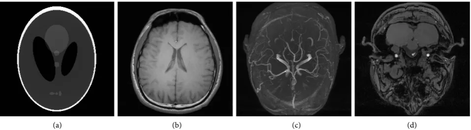 Figure 4. Fully sampled reconstruction simulation images: (a) Shepp-Logan phantom 256 × 256; (b) T1 MRI image 256 × 256; (c) TOF MRI MIP image 192 × 512 × 512 8 channel; (d) TOF MRI (one slice) image 512 × 512