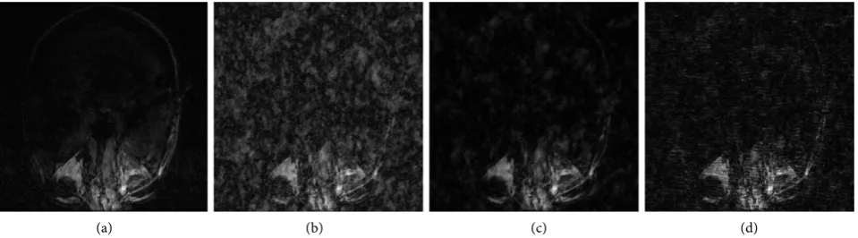 Figure 6. TOF reconstruction with 38% random under-sampling, receiver 1, slice 1. (a) Fully sampled; (b) Linear; (c) TIWT CS; (d) TV CS