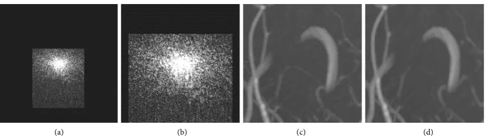 Figure 3. TOF MRI k-space data (1 receiver) and MIP reconstruction zoomed in (a) High resolution 512 × 512 data; (b) Cropped low resolution 256 × 256; (c) High resolution reconstruction; (d) Cropped low resolution reconstruction