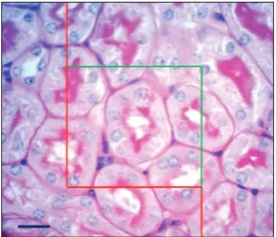 Fig. 3. For estimating the numerical density of glomeruli accord-ing to the physical dissector method, the images of two sections 20 µm apart (1st and 5th sections) were used as (a) a reference and (b) the look-up section, respectively