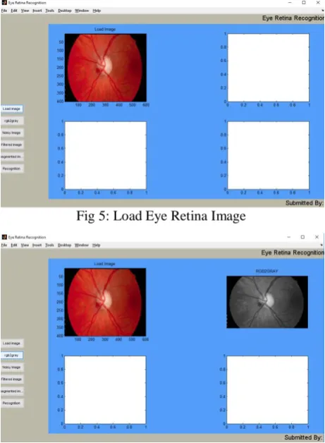 Fig 5: Load Eye Retina Image  
