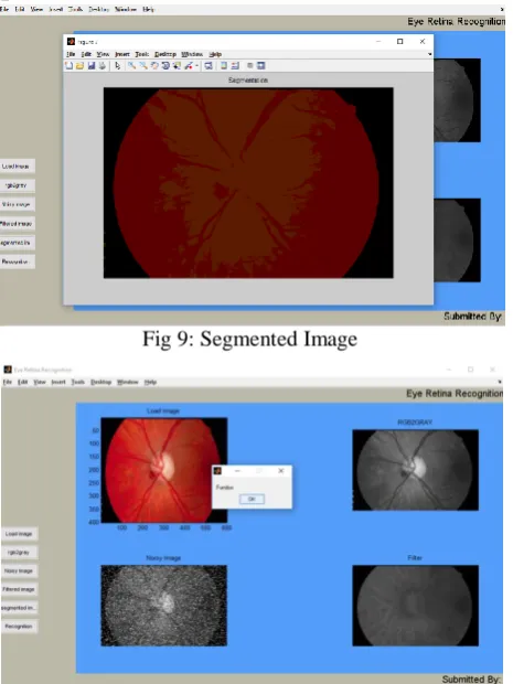 Fig 9: Segmented Image 