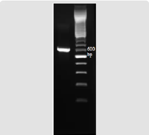 Figure 5: Phylogenetic relationship between the strain AUN-S18 and other 26S rRNA gene sequences of published Schwanniomyces strains.