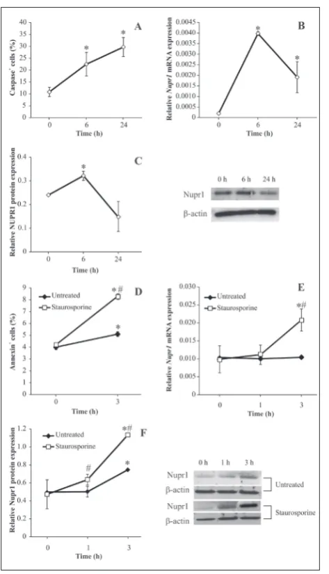 Fig. 2. The role of NUPR1 in immune cell apoptosis. Cervical lymph node cells were either tested immediately after isolation (0 h) or kept in RPMI-1640 and 5% FBS medium in the incubator for 6 h or 24 h