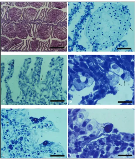 Fig. 2. Light micrograph of Prespa barbel gill. A – Extensive telan-giectasia. Paraffin section H&E