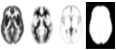 Figure 1: The a priori probability images of GM, WM, CSF and non-brain  tissue. Values range between zero (white) and one (black)