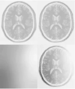 Figure . 2: The MR images are modelled as a number of distinct clusters (top left), with different levels of Gaussian random noise added to each cluster (top right)